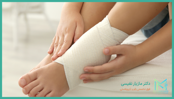 علائم کشیدگی تاندون مچ پا