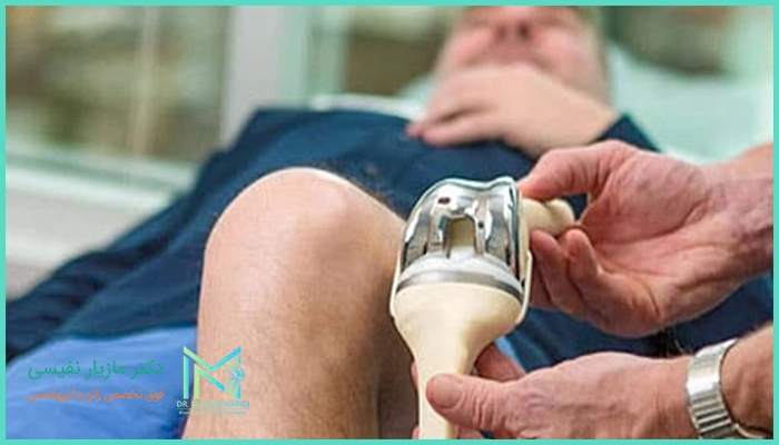 عوامل موثر بر هزینه تعویض مفصل زانو