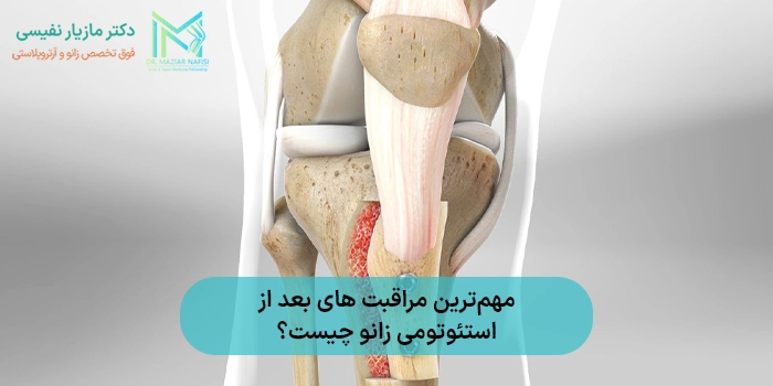 مهمترین مراقبت های بعد از استئوتومی زانو